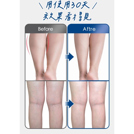 【TREAS HUNTER】legsEase 纖潤美腿儀 美腿儀 腳(雙入組) 【TREAS HUNTER】legsEase 纖潤美腿儀 美腿儀 腳(雙入組)